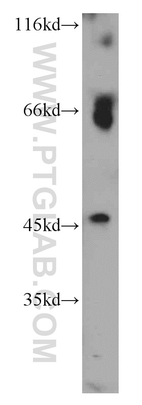 Western Blot (WB) analysis of Jurkat cells using CHRNA7/CHRFAM7A Polyclonal antibody (21586-1-AP)