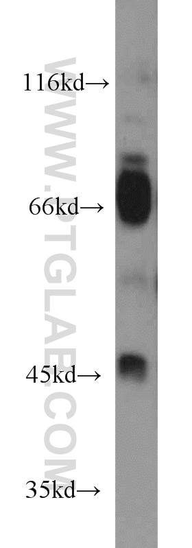 Western Blot (WB) analysis of Jurkat cells using CHRNA7/CHRFAM7A Polyclonal antibody (21586-1-AP)