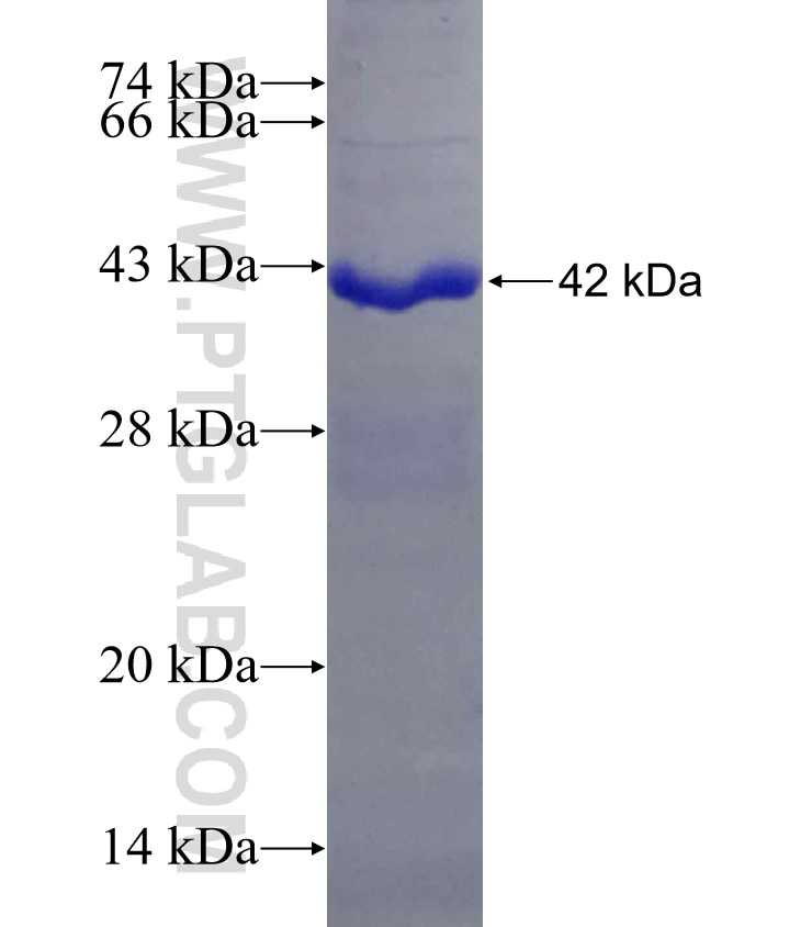 CHRFAM7A fusion protein Ag16151 SDS-PAGE
