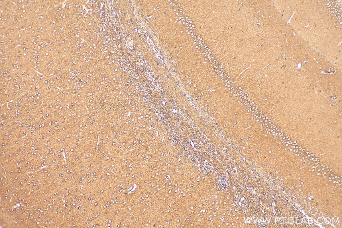 Immunohistochemical analysis of paraffin-embedded mouse brain tissue slide using 21978-1-AP (CHRM3 antibody) at dilution of 1:200 (under 10x lens). Heat mediated antigen retrieval with Tris-EDTA buffer (pH 9.0). Immunohistochemistry (IHC) staining of mouse brain tissue using CHRM3 Polyclonal antibody (21978-1-AP)