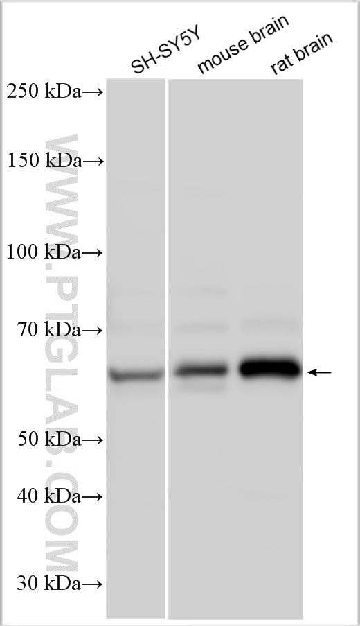 Western Blot (WB) analysis of various lysates using CHRM3 Polyclonal antibody (21978-1-AP)