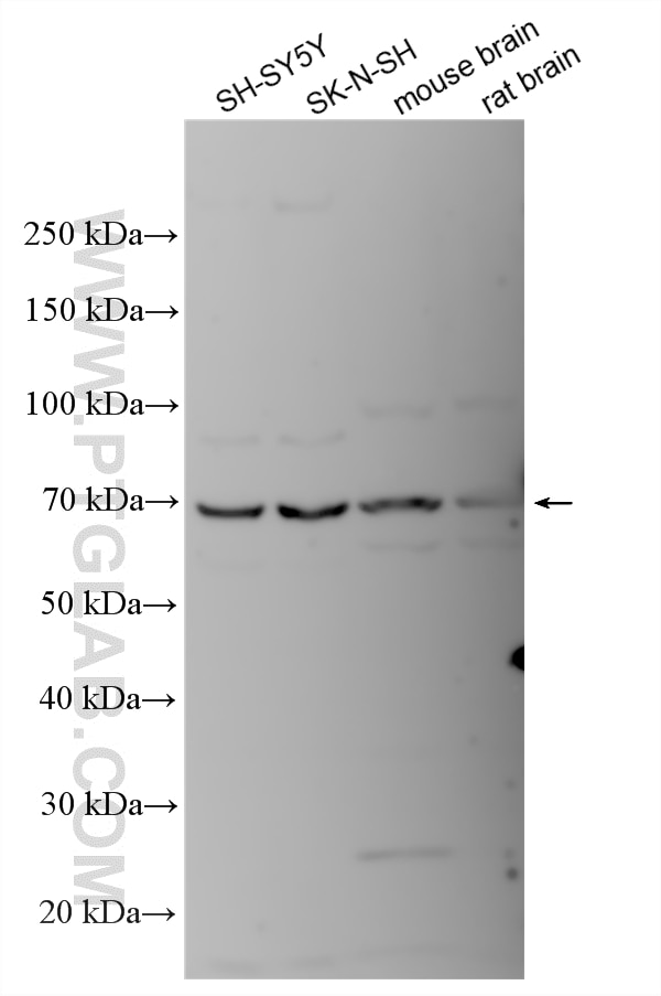 Various lysates were subjected to SDS PAGE followed by western blot with 21978-1-AP (CHRM3 antibody) at dilution of 1:3000 incubated at room temperature for 1.5 hours. Western Blot (WB) analysis of various lysates using CHRM3 Polyclonal antibody (21978-1-AP)