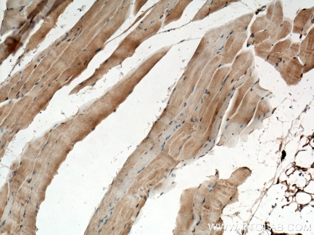 Immunohistochemistry (IHC) staining of mouse skeletal muscle tissue using CHRNA1 Polyclonal antibody (10613-1-AP)