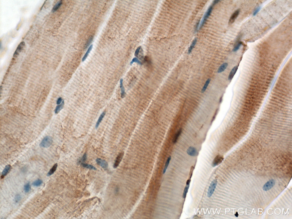 Immunohistochemistry (IHC) staining of mouse skeletal muscle tissue using CHRNA1 Polyclonal antibody (10613-1-AP)