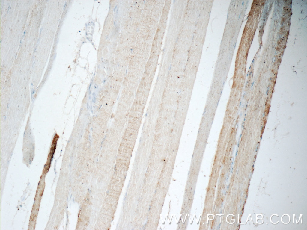 IHC staining of human skeletal muscle using 10613-1-AP