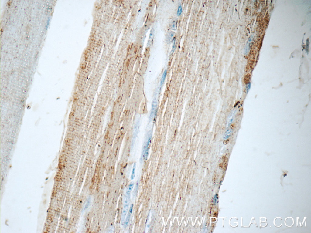 Immunohistochemistry (IHC) staining of human skeletal muscle tissue using CHRNA1 Polyclonal antibody (10613-1-AP)