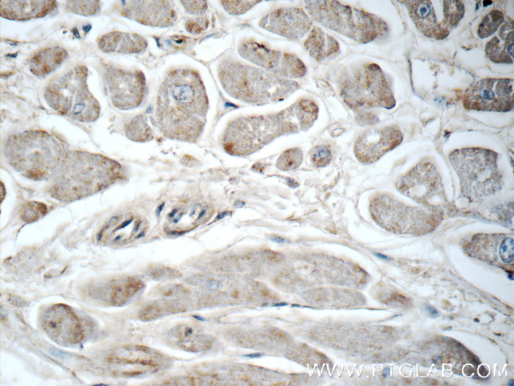 Immunohistochemistry (IHC) staining of human heart tissue using CHRNA1 Polyclonal antibody (10613-1-AP)