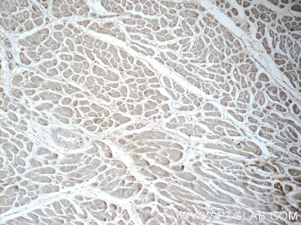 Immunohistochemistry (IHC) staining of human heart tissue using CHRNA1 Polyclonal antibody (10613-1-AP)