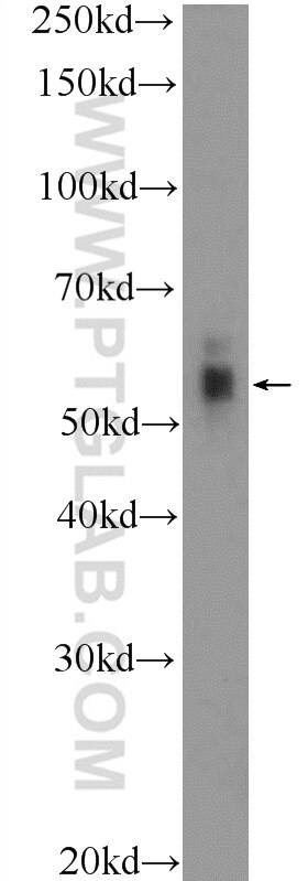 CHRNA1