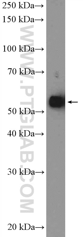 CHRNA1 Polyclonal antibody