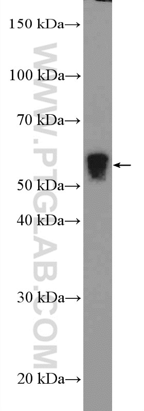 Western Blot (WB) analysis of rat heart tissue using CHRNA1 Polyclonal antibody (10613-1-AP)
