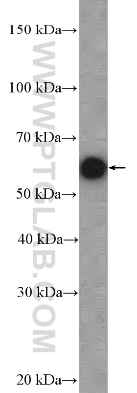 Western Blot (WB) analysis of mouse heart tissue using CHRNA1 Polyclonal antibody (10613-1-AP)