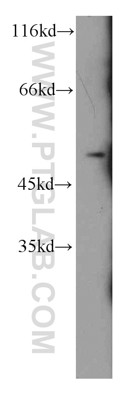 Western Blot (WB) analysis of Jurkat cells using CHRNA10 Polyclonal antibody (55291-1-AP)