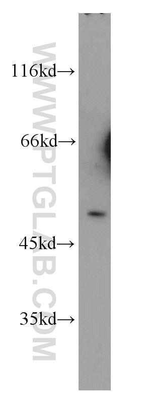 Western Blot (WB) analysis of Raji cells using CHRNA10 Polyclonal antibody (55291-1-AP)