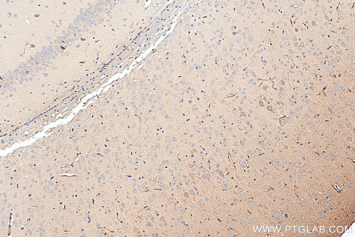 Immunohistochemistry (IHC) staining of mouse brain tissue using CHRNA3 Polyclonal antibody (10333-1-AP)