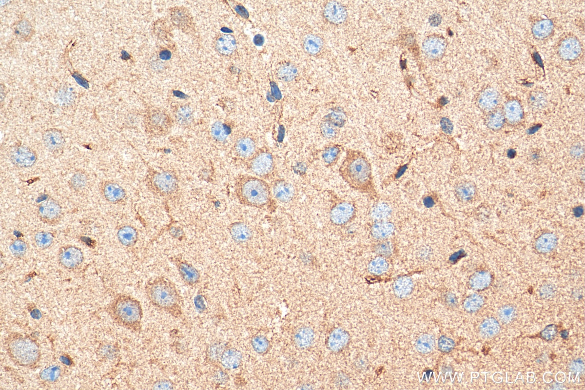 Immunohistochemistry (IHC) staining of mouse brain tissue using CHRNA3 Polyclonal antibody (10333-1-AP)