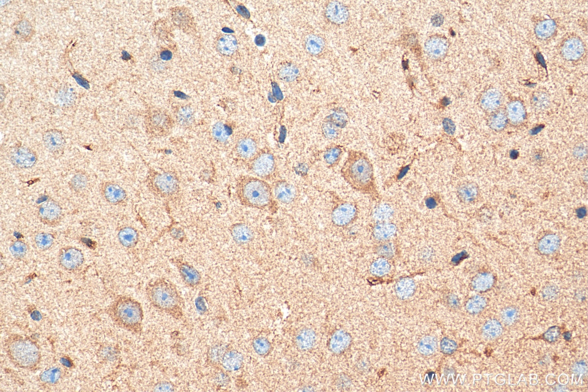 Immunohistochemistry (IHC) staining of mouse brain tissue using CHRNA3 Polyclonal antibody (10333-1-AP)