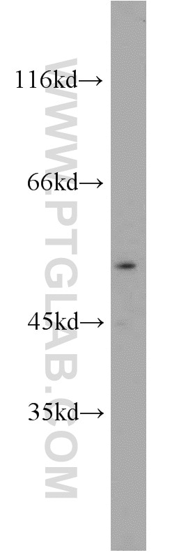 WB analysis of mouse brain using 10333-1-AP