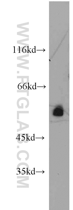 Western Blot (WB) analysis of HepG2 cells using CHRNA3 Polyclonal antibody (10333-1-AP)