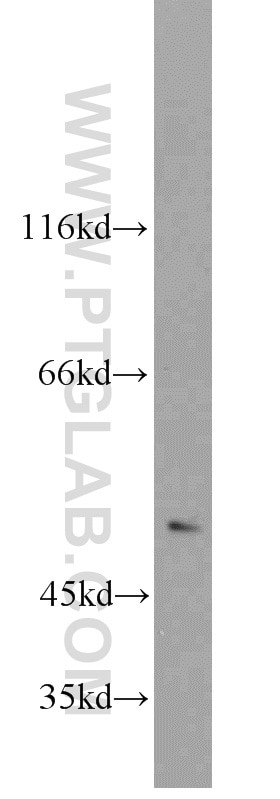 Western Blot (WB) analysis of mouse thymus tissue using CHRNA3 Polyclonal antibody (10333-1-AP)