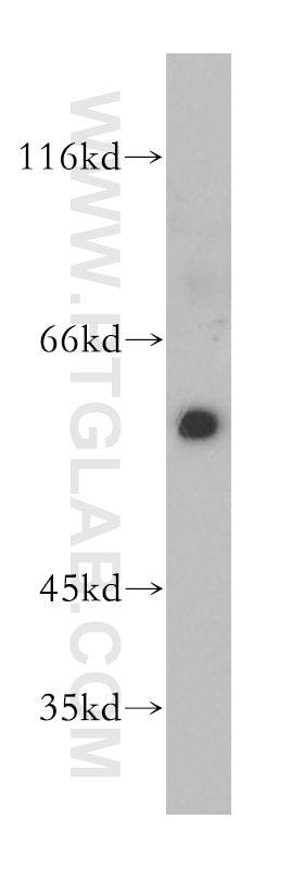 Western Blot (WB) analysis of HEK-293 cells using CHRNA3 Polyclonal antibody (10333-1-AP)