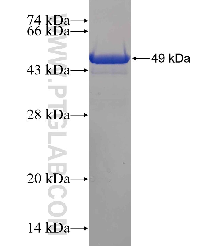 CHRNA3 fusion protein Ag0272 SDS-PAGE