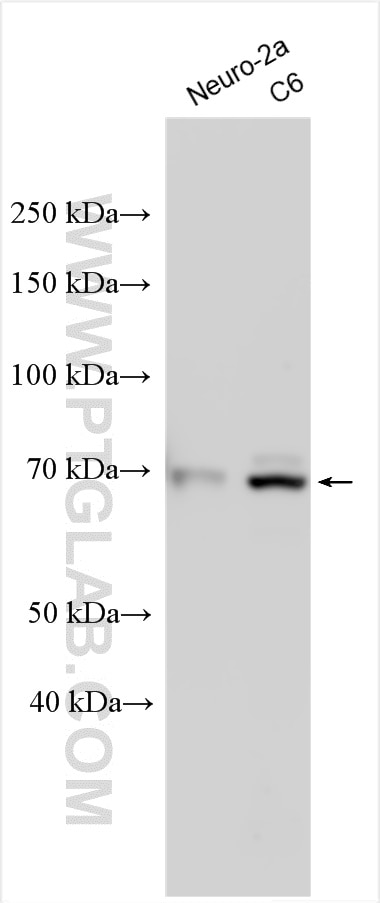 Western Blot (WB) analysis of various lysates using CHRNA4 Polyclonal antibody (21939-1-AP)