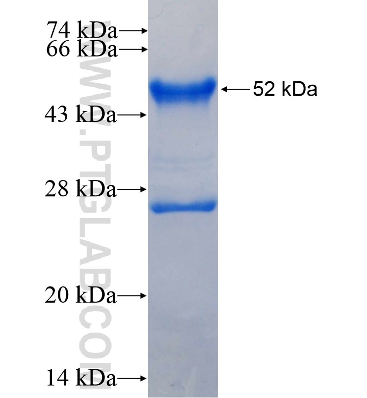 CHRNA4 fusion protein Ag16584 SDS-PAGE