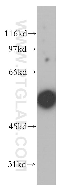 Western Blot (WB) analysis of A431 cells using CHRNA5 Polyclonal antibody (13516-1-AP)