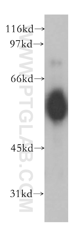 Western Blot (WB) analysis of Jurkat cells using CHRNA5 Polyclonal antibody (13516-1-AP)