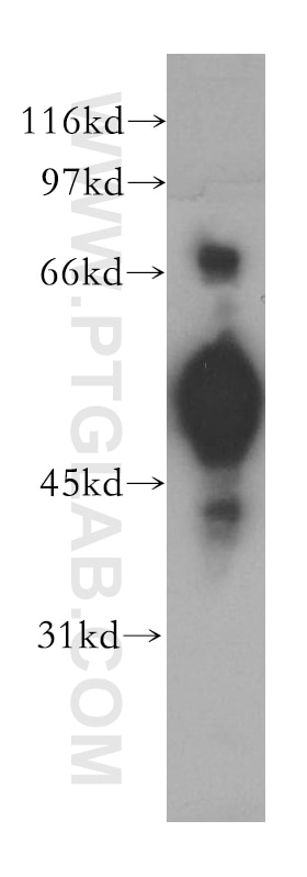 Western Blot (WB) analysis of A549 cells using CHRNA5 Polyclonal antibody (13516-1-AP)