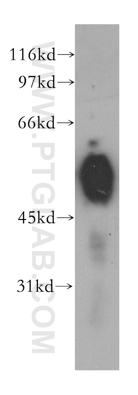 Western Blot (WB) analysis of mouse stomach tissue using CHRNA5 Polyclonal antibody (13516-1-AP)