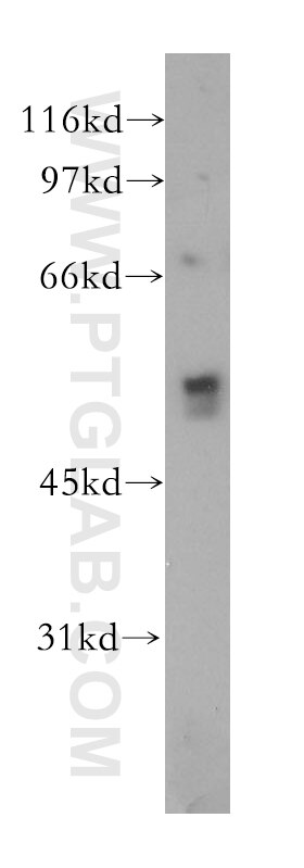 Western Blot (WB) analysis of mouse bladder tissue using CHRNA5 Polyclonal antibody (13516-1-AP)