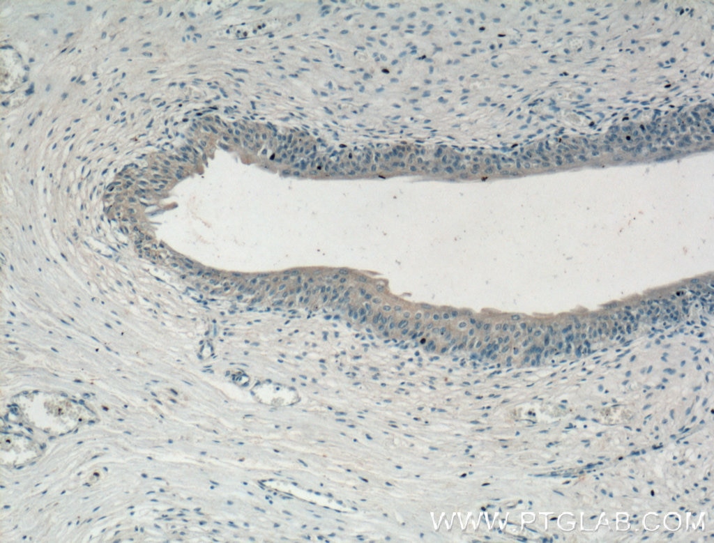 Immunohistochemistry (IHC) staining of human bladder tissue using CHRNA5 Monoclonal antibody (66363-1-Ig)