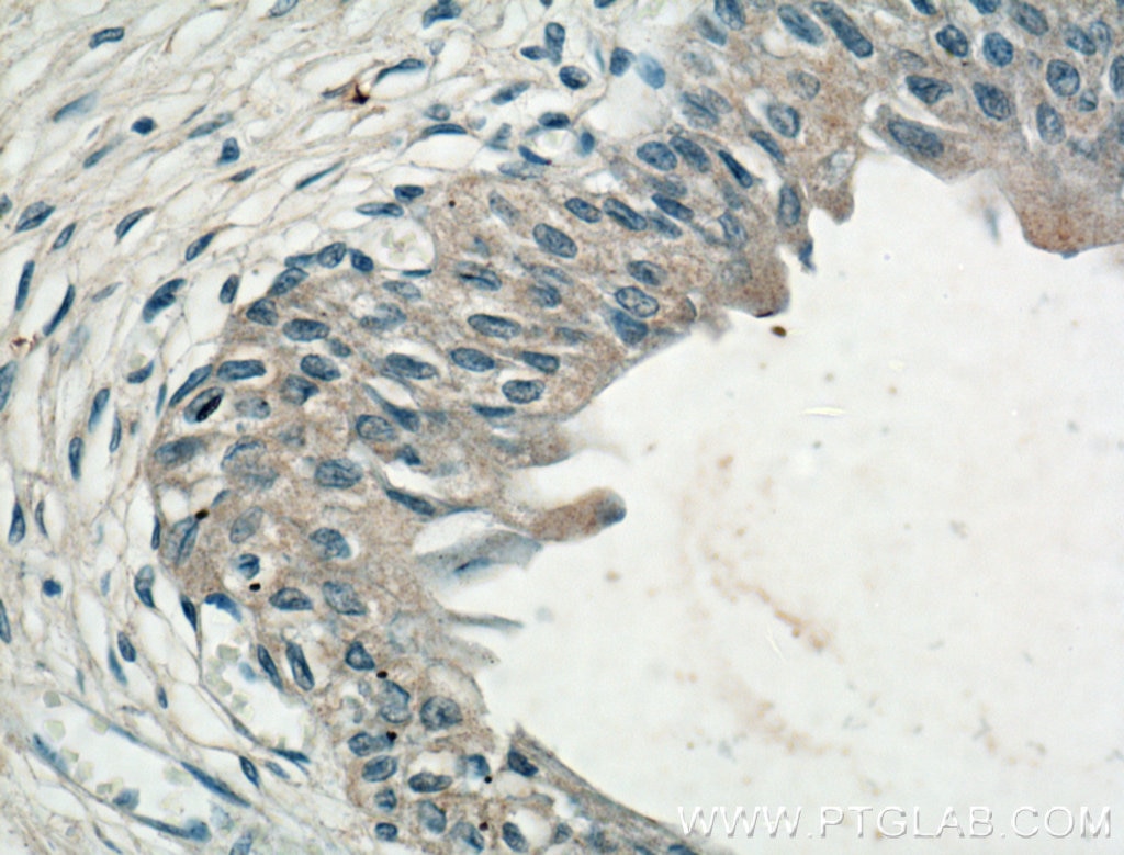 Immunohistochemistry (IHC) staining of human bladder tissue using CHRNA5 Monoclonal antibody (66363-1-Ig)