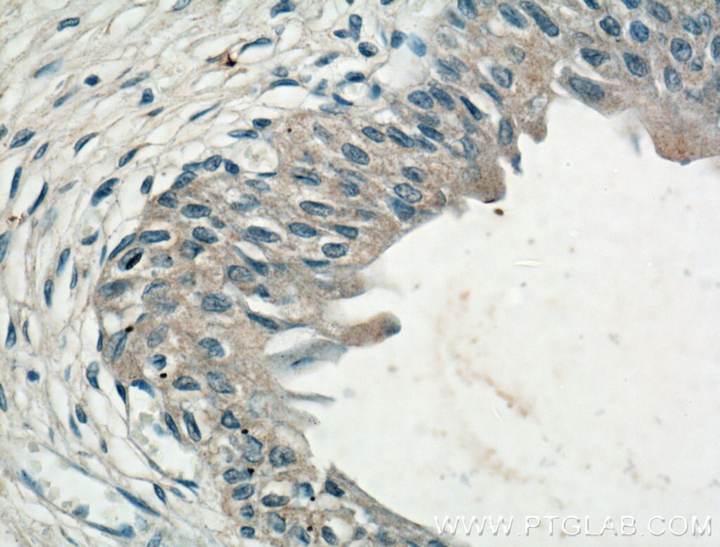 IHC staining of human bladder using 66363-1-Ig