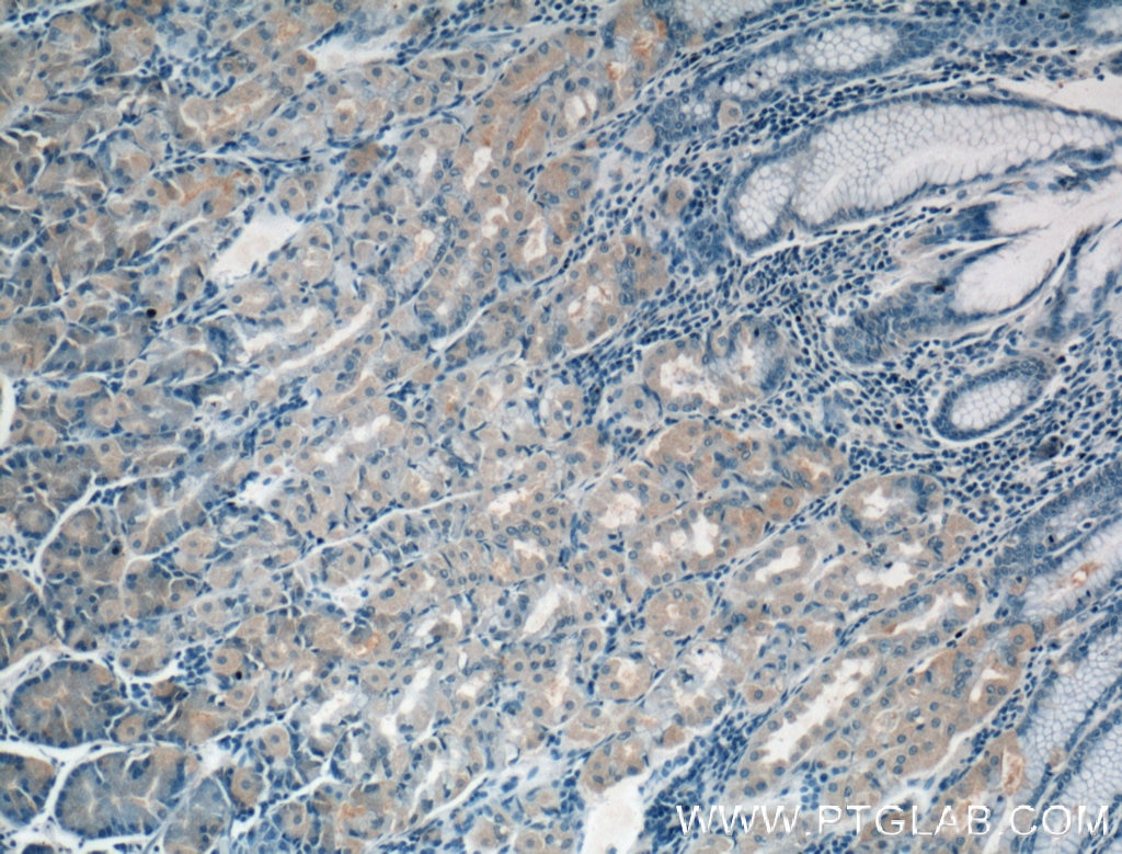 IHC staining of human stomach using 66363-1-Ig