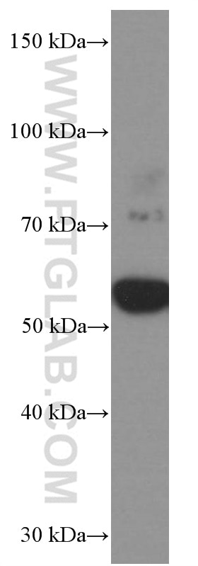 Western Blot (WB) analysis of C2C12 cells using CHRNA5 Monoclonal antibody (66363-1-Ig)