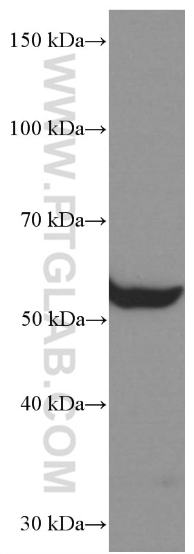 Western Blot (WB) analysis of human skeletal muscle tissue using CHRNA5 Monoclonal antibody (66363-1-Ig)