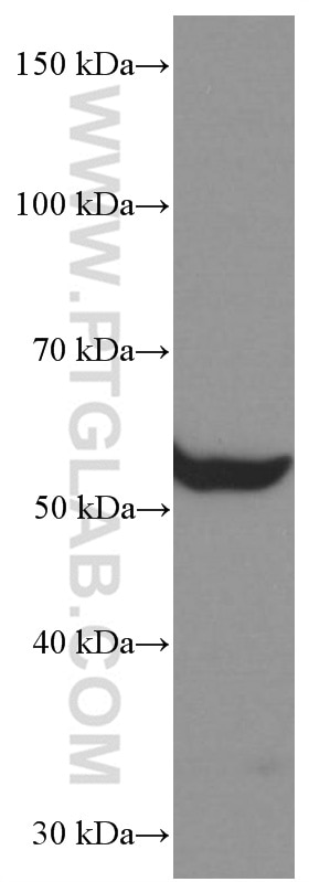 WB analysis of human skeletal muscle using 66363-1-Ig