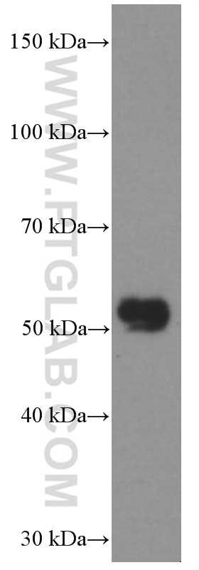 Western Blot (WB) analysis of mouse skeletal muscle tissue using CHRNA5 Monoclonal antibody (66363-1-Ig)