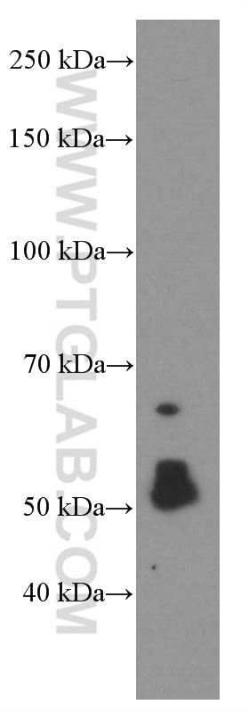 Western Blot (WB) analysis of pig skeletal muscle tissue using CHRNA5 Monoclonal antibody (66363-1-Ig)