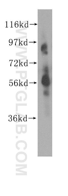 Western Blot (WB) analysis of mouse thymus tissue using CHRNA6 Polyclonal antibody (11388-1-AP)