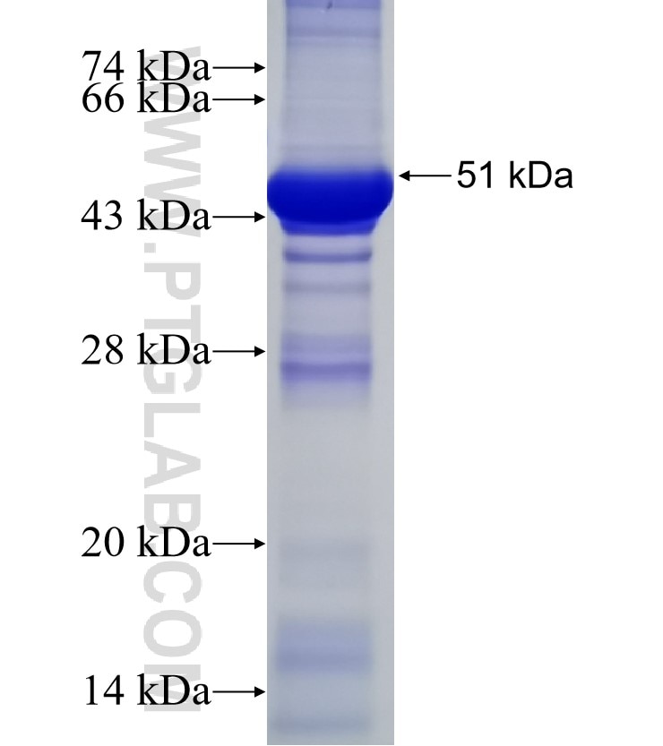 CHRNA6 fusion protein Ag1921 SDS-PAGE
