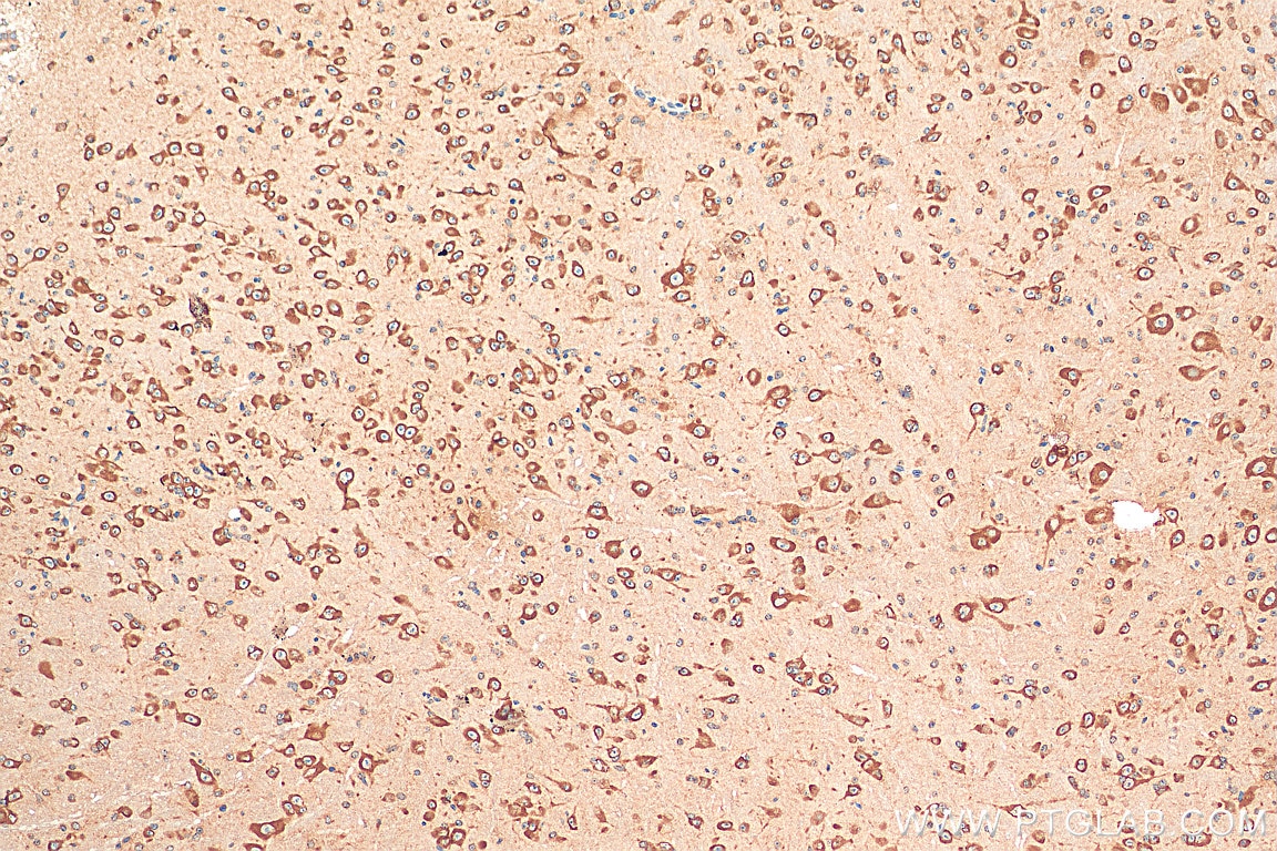 IHC staining of mouse brain using 21379-1-AP