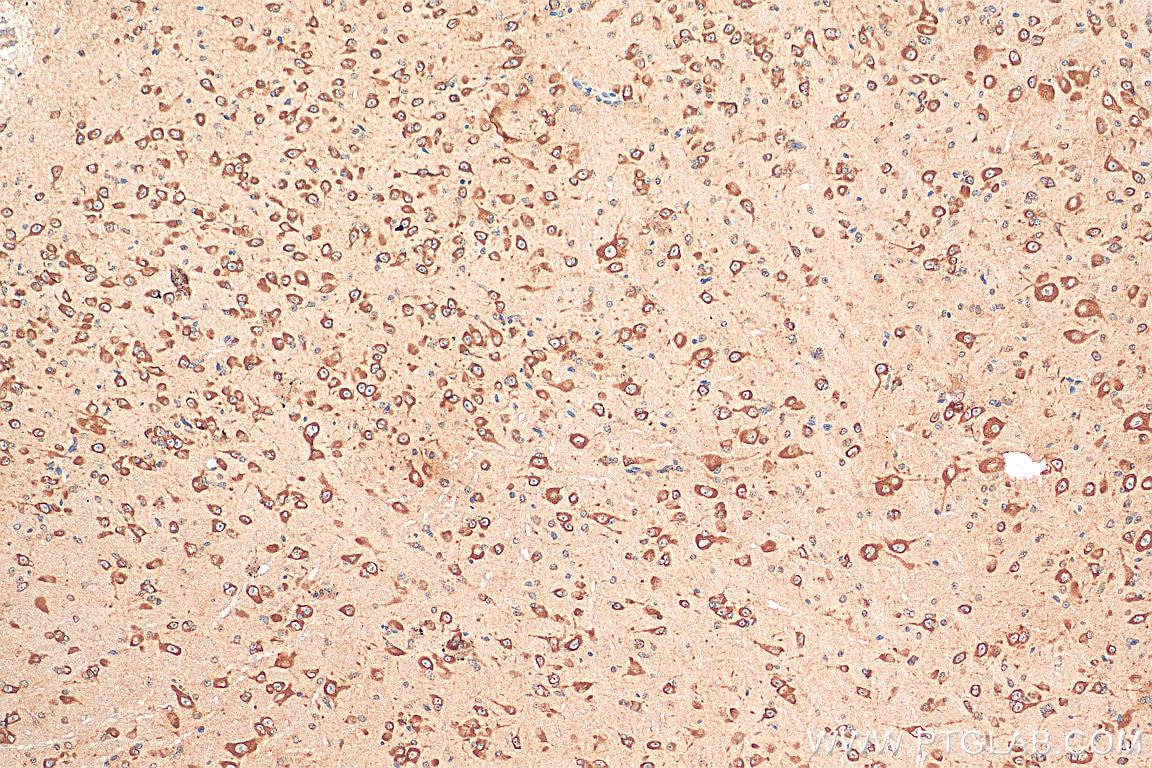 Immunohistochemistry (IHC) staining of mouse brain tissue using CHRNA7 Polyclonal antibody (21379-1-AP)