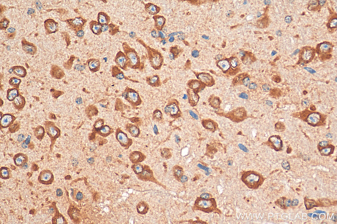 Immunohistochemistry (IHC) staining of mouse brain tissue using CHRNA7 Polyclonal antibody (21379-1-AP)