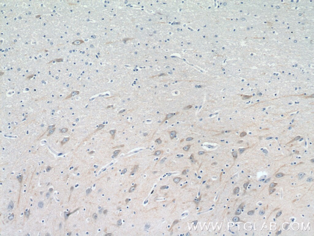 Immunohistochemistry (IHC) staining of human brain tissue using CHRNA7 Polyclonal antibody (21379-1-AP)