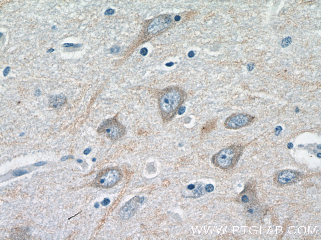 Immunohistochemistry (IHC) staining of human brain tissue using CHRNA7 Polyclonal antibody (21379-1-AP)