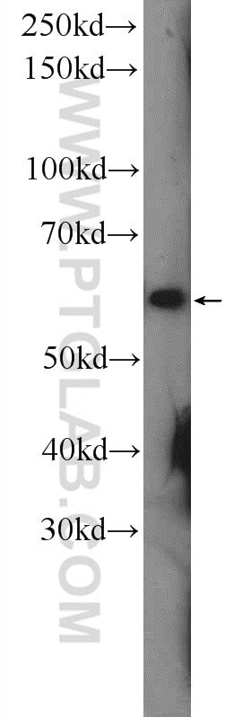 Western Blot (WB) analysis of rat brain tissue using CHRNA7 Polyclonal antibody (21379-1-AP)